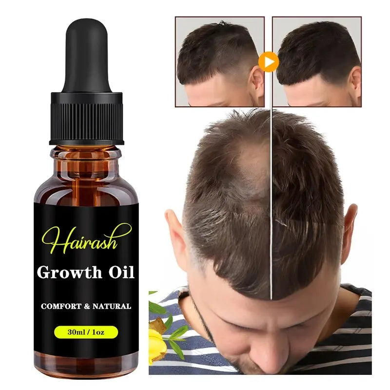 Lace Wig Glue And Lace Tint Spray And Remover For Front Lace Wig Melting Band Hair Wax Stick Glue Pen Growth Oil Install Kit